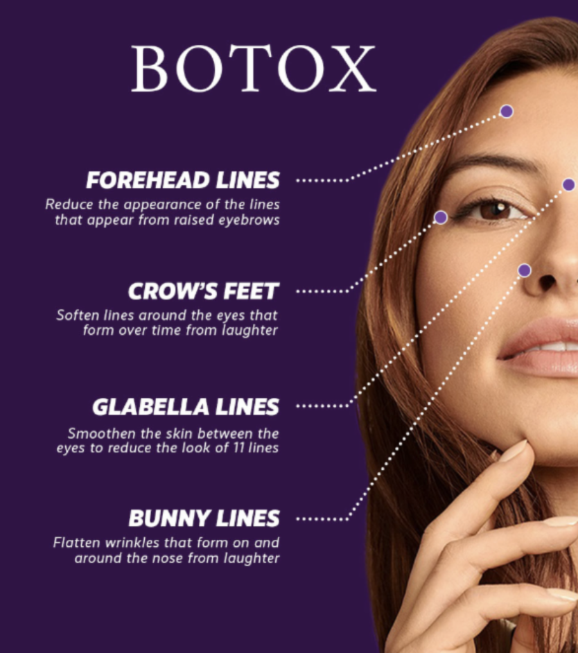 botox